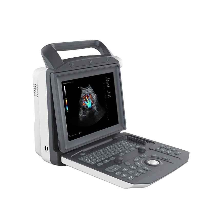 PCDU05 Buy Ultrasound Scanner with Extended Imaging 3d 4d Portable Color Digital Doppler Ultrasound Machine
PCDU05 Buy Ultrasound Scanner with Extended Imaging 3d 4d Portable Color Digital Doppler Ultrasound Machine