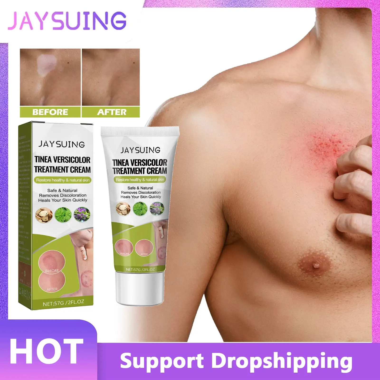 Jaysuing Tinea Versicolor Cream Treatment Psoriasis Dermatitis White Spot Ointment Antibacterial Inhibit Anti Itching Cream 57g
Jaysuing Tinea Versicolor Cream Treatment Psoriasis Dermatitis White Spot Ointment Antibacterial Inhibit Anti Itching Cream 57g