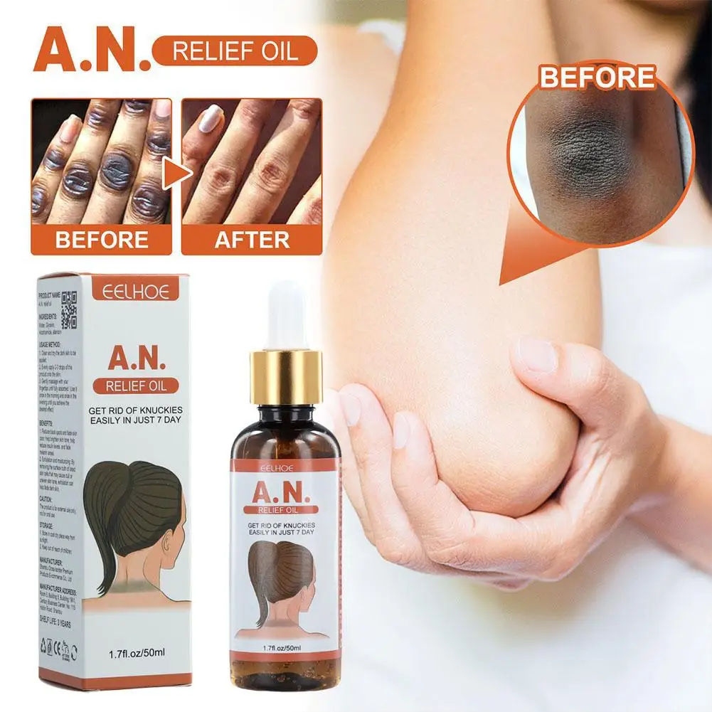 50ml Acanthosis Nigricans Therapy Oil Dark Spot Corrector Oil Dark Knuckle Whitening Serum For Removing Dark Knuckle Joint N7G4
50ml Acanthosis Nigricans Therapy Oil Dark Spot Corrector Oil Dark Knuckle Whitening Serum For Removing Dark Knuckle Joint N7G4