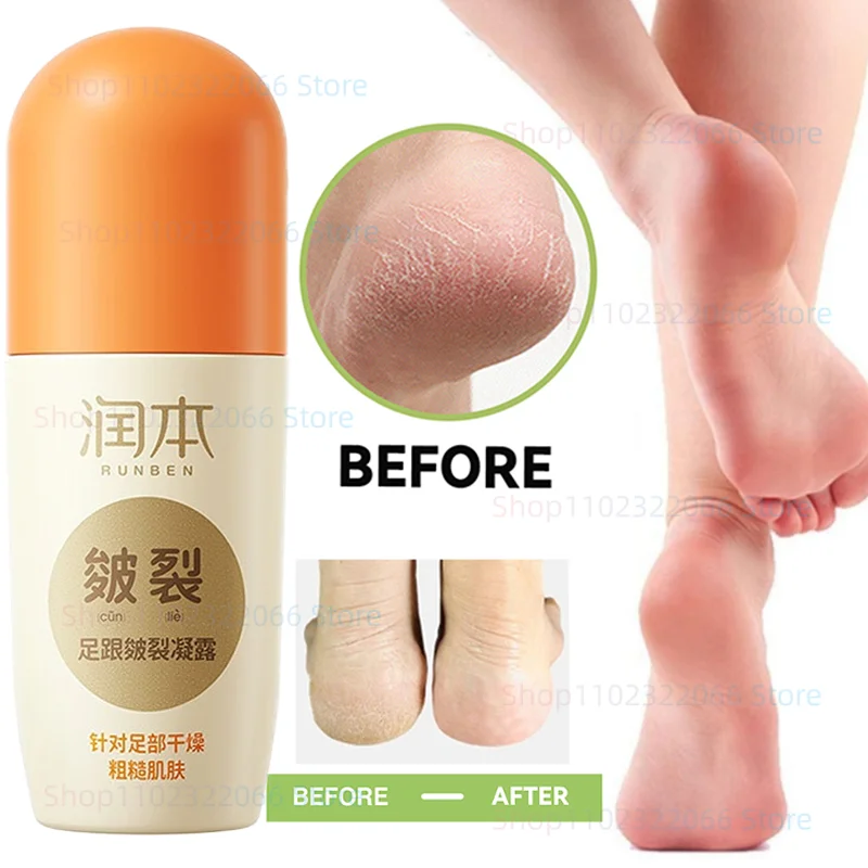 Anti-cracking Foot Cream Anti-cracking Heel Cracking Repair Calluses Dead Skin Removal Foot Film Moisturizing Hand and Foot Care
Anti-cracking Foot Cream Anti-cracking Heel Cracking Repair Calluses Dead Skin Removal Foot Film Moisturizing Hand and Foot Care