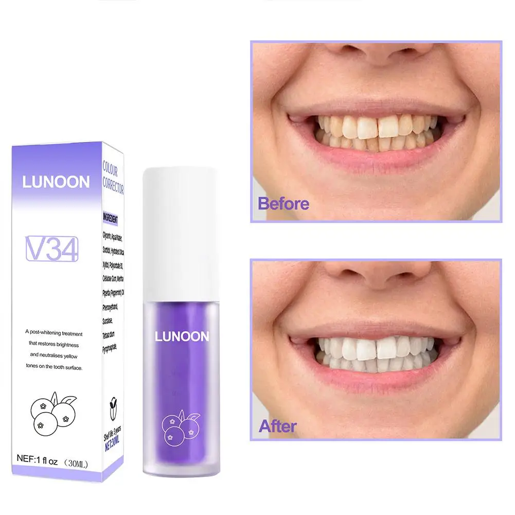 V34 Teeth Toothpaste Cleaning Purple Whitening Toothpaste Removing Yellow Dropship Tooth Cleaning Oral Teeth Hygiene 30ml S W3K1
V34 Teeth Toothpaste Cleaning Purple Whitening Toothpaste Removing Yellow Dropship Tooth Cleaning Oral Teeth Hygiene 30ml S W3K1