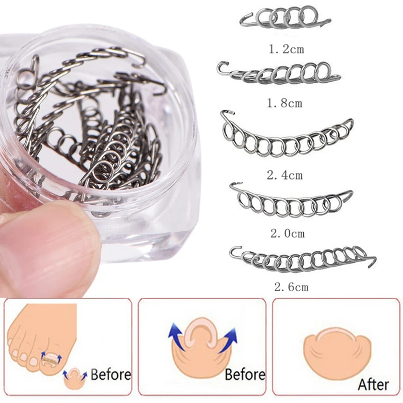 12pcs/box Ingrown Toenail Correction Tool Ingrown Toe Nail Treatment Elastic Wire Fixer Straightening Clip Brace Pedicure Tools
12pcs/box Ingrown Toenail Correction Tool Ingrown Toe Nail Treatment Elastic Wire Fixer Straightening Clip Brace Pedicure Tools