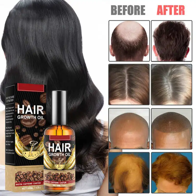 Hair Care 50ml Hair Serum Caffeine Strengthening Hydrating Repair Damaged Promote Growth Hair Repair Serum Hair Products
Hair Care 50ml Hair Serum Caffeine Strengthening Hydrating Repair Damaged Promote Growth Hair Repair Serum Hair Products