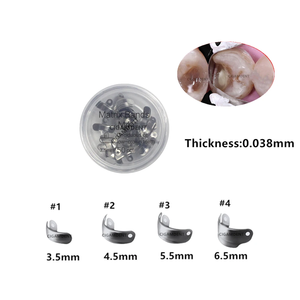 50Pcs Dental Matrix Bands Sectional Contoured Matrices Matrix Ring Wedges Clamp Holder Composite Resin Filling Instruments
50Pcs Dental Matrix Bands Sectional Contoured Matrices Matrix Ring Wedges Clamp Holder Composite Resin Filling Instruments