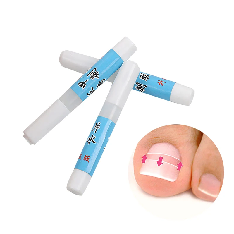 1Pcs Professional Embedded Toe Nail Corrector Nail Repair Nail Glue Ingrown Toenail Correction Foot Care Tool
1Pcs Professional Embedded Toe Nail Corrector Nail Repair Nail Glue Ingrown Toenail Correction Foot Care Tool