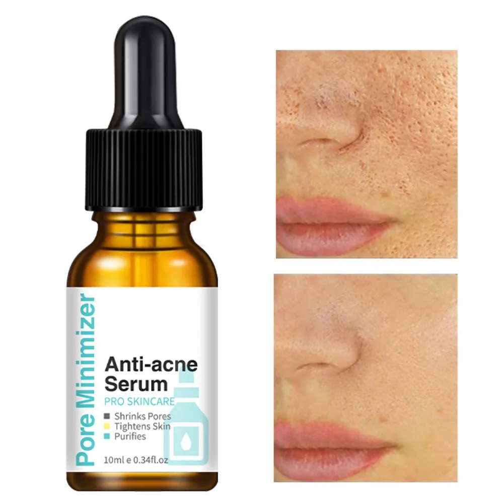 

Pore Shrink Face Serum Deep Clean Moisturizing Nourishing Whitening Spot Essence Firming Brighten Anti-acnes Regenerative