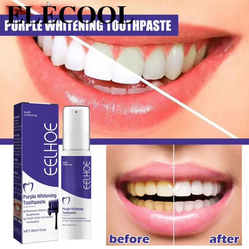 Tooth Whitening Toothpaste White Reduced Sensitivity More Effective Than Traditional Select Safe Ingredients Tooth Whiteners
Tooth Whitening Toothpaste White Reduced Sensitivity More Effective Than Traditional Select Safe Ingredients Tooth Whiteners