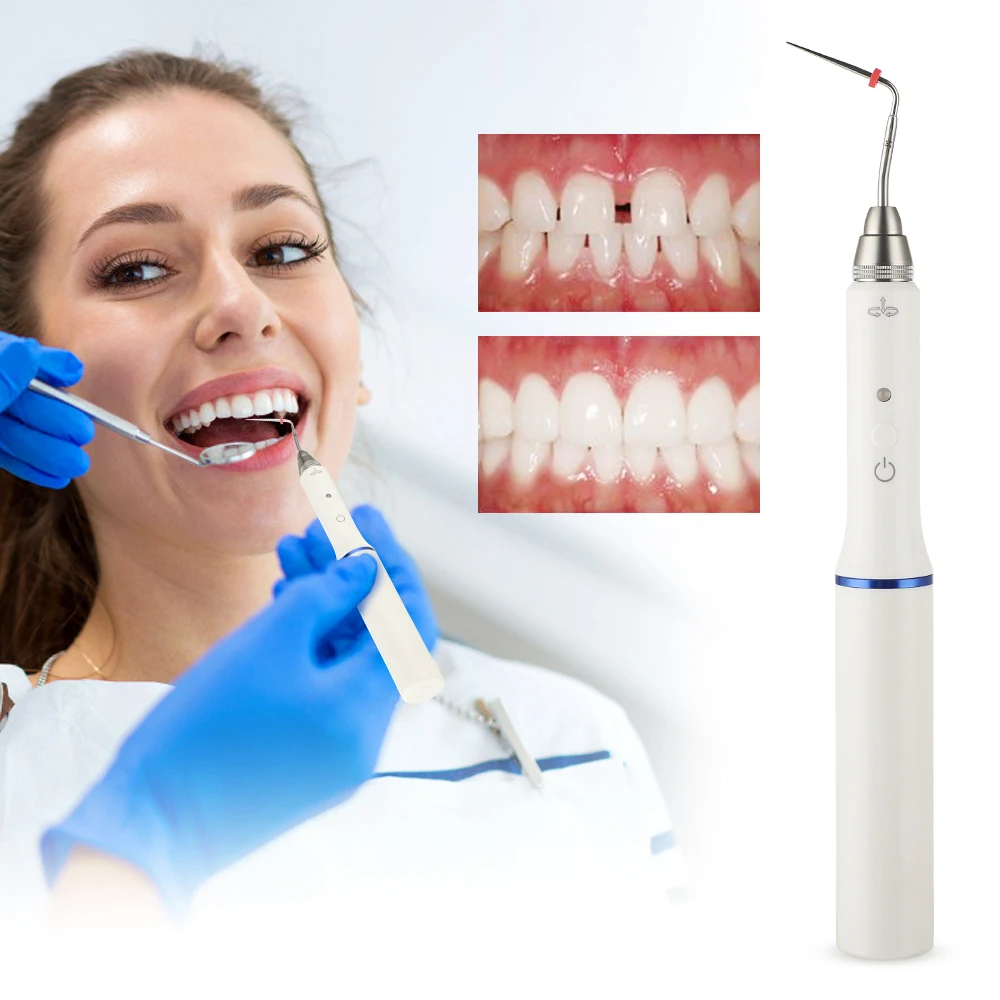 Dental Cordless Wireless Endo Gutta Percha Obturation Teeth Whitening Oral Hygiene Tooth Gum Dental Gutta Percha with 2 Tips
Dental Cordless Wireless Endo Gutta Percha Obturation Teeth Whitening Oral Hygiene Tooth Gum Dental Gutta Percha with 2 Tips