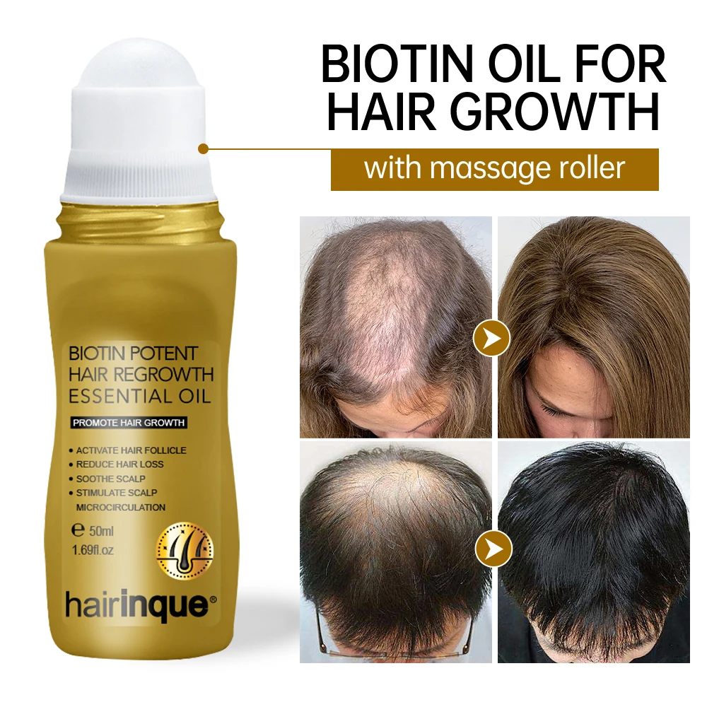 Biotin Oil For Hair Growth Products Men Women Anti Hair Loss Roller Scalp Massager Treatment Fast Grow Bald Serum Hair Oil Care
Biotin Oil For Hair Growth Products Men Women Anti Hair Loss Roller Scalp Massager Treatment Fast Grow Bald Serum Hair Oil Care