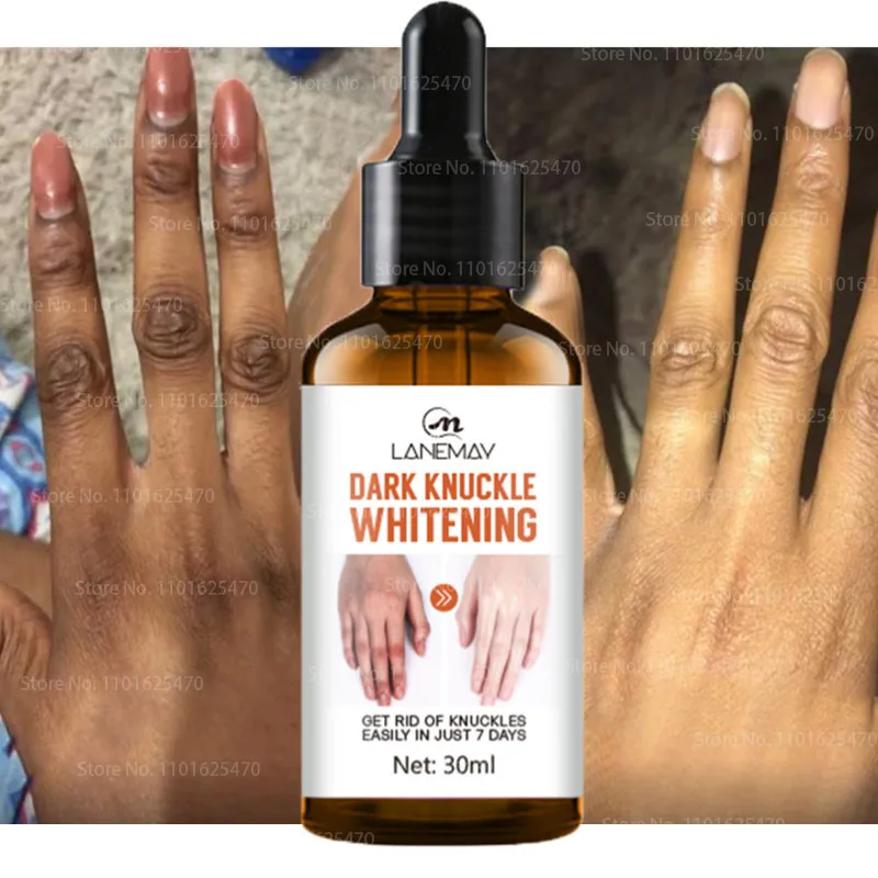 Joint Blackening Artifact Whitening Essence Private Parts Armpits Knees Ankles Lighten Melanin Body Powder Tender Essential Oil
Joint Blackening Artifact Whitening Essence Private Parts Armpits Knees Ankles Lighten Melanin Body Powder Tender Essential Oil