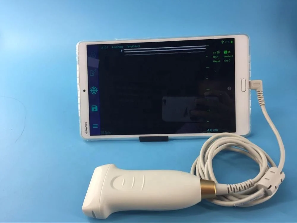 

Smart function USB pocket ultrasound PW function linear probe for vascular