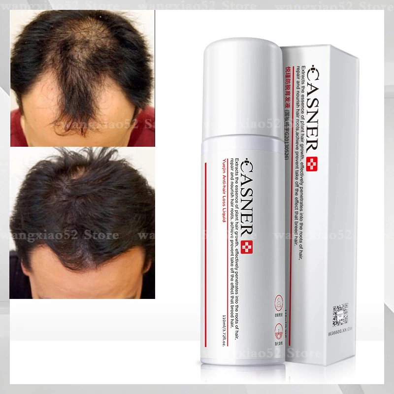 Hair care solution Anti-fall hair dense hair nourishing essence Hairline hair growth agent for men and women hair growth serum
Hair care solution Anti-fall hair dense hair nourishing essence Hairline hair growth agent for men and women hair growth serum