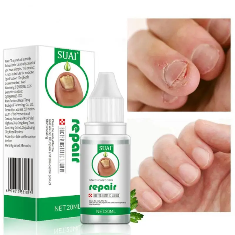 Nail Treatments Gray Nail Repair Liquid Anti-Fungus Antibacterial Onychomycosis Removal Essence Foot Toe Nail Care Accessories
Nail Treatments Gray Nail Repair Liquid Anti-Fungus Antibacterial Onychomycosis Removal Essence Foot Toe Nail Care Accessories