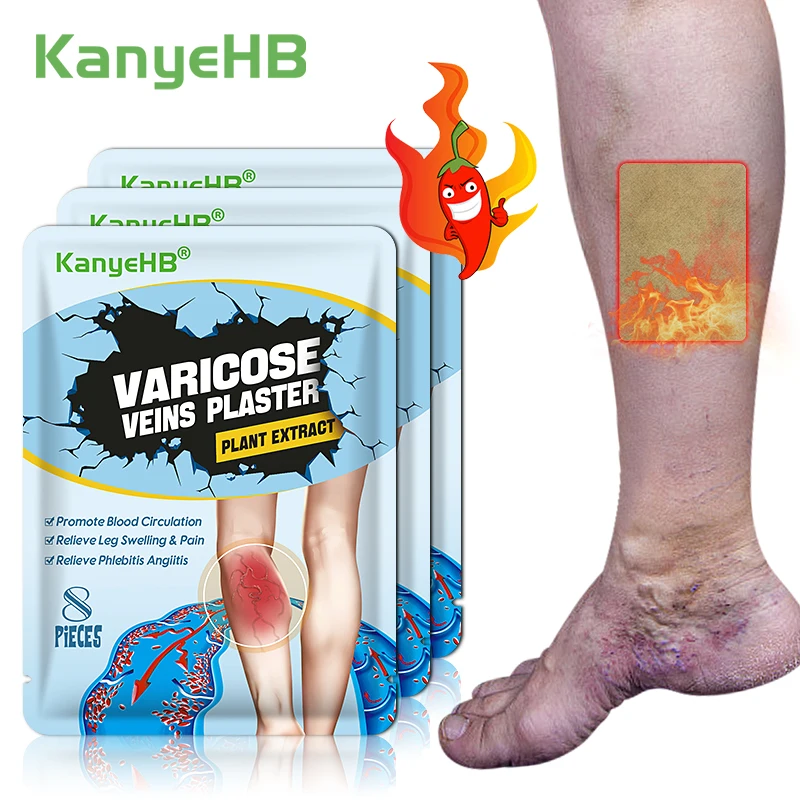 24pcs=3bags Varicose Veins Remove Sticker Vasculitis Phlebitis Medical Plaster Treatment Varicosity Angiitis Spider Vasodilation
24pcs=3bags Varicose Veins Remove Sticker Vasculitis Phlebitis Medical Plaster Treatment Varicosity Angiitis Spider Vasodilation