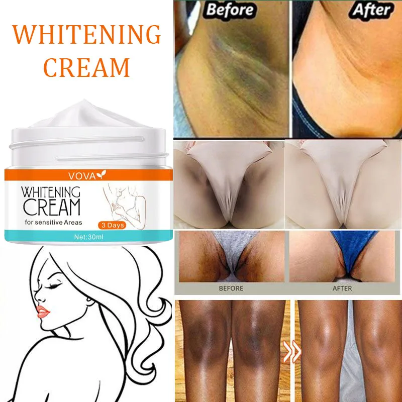 Body Whitening Cream Private Parts Underarm Knee Ankle Joint Bleaching Remove Melanin Pigmentation Brighten Moisturize Skin Care
Body Whitening Cream Private Parts Underarm Knee Ankle Joint Bleaching Remove Melanin Pigmentation Brighten Moisturize Skin Care