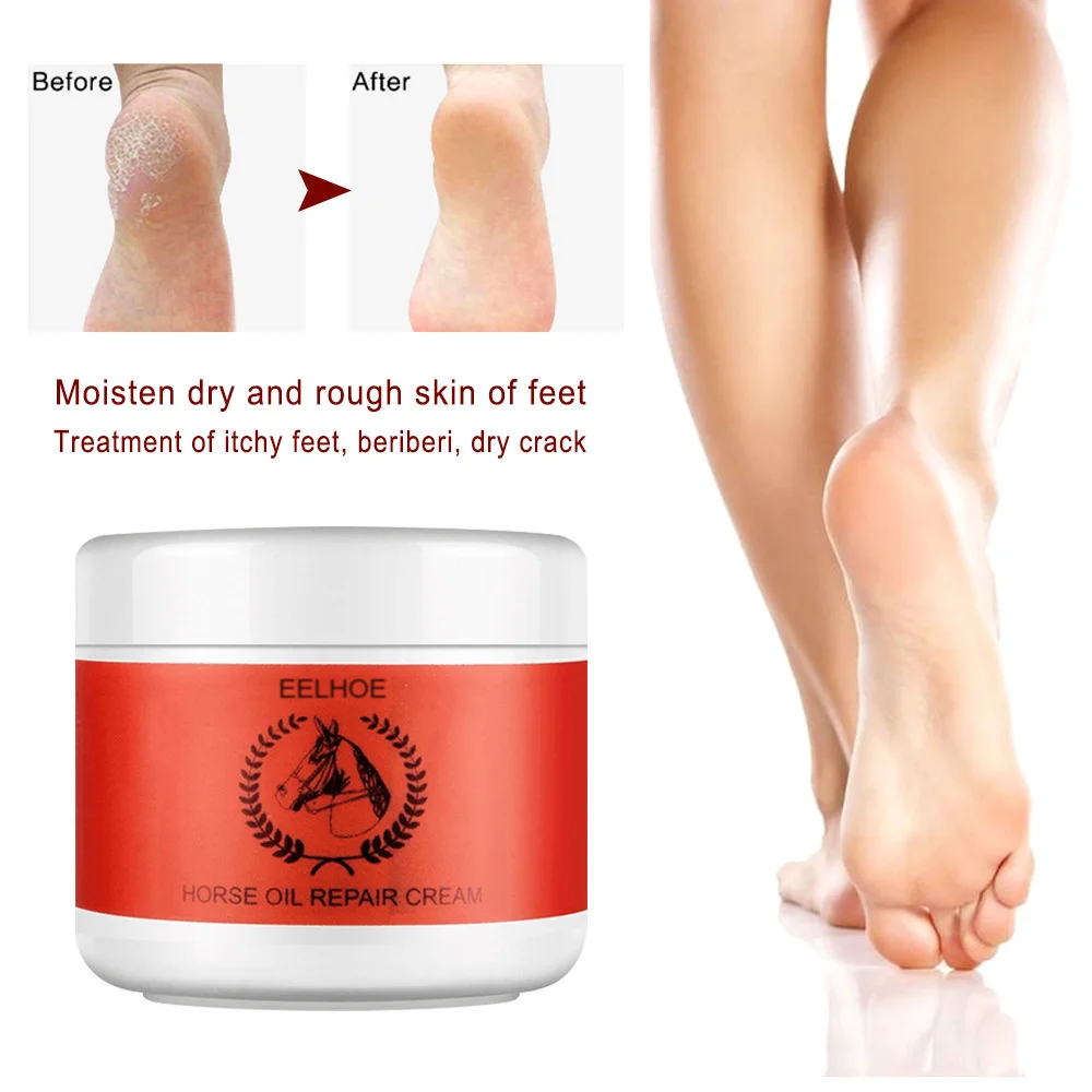 Horse Oil Foot Cream Moisturizing Nourish Repair Skin Care Relieve Dryness Anti Chapping Peel Heel Mask Beauty Health Product
Horse Oil Foot Cream Moisturizing Nourish Repair Skin Care Relieve Dryness Anti Chapping Peel Heel Mask Beauty Health Product