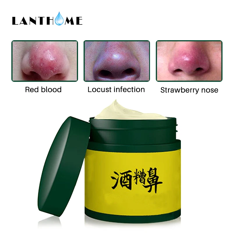 Rosacea Cream Red Nose Ointment Remove Skin Redness Herbal Anti Acne and Mite Treat Reduce Pigmentation Brandy Nose Red Nose
Rosacea Cream Red Nose Ointment Remove Skin Redness Herbal Anti Acne and Mite Treat Reduce Pigmentation Brandy Nose Red Nose