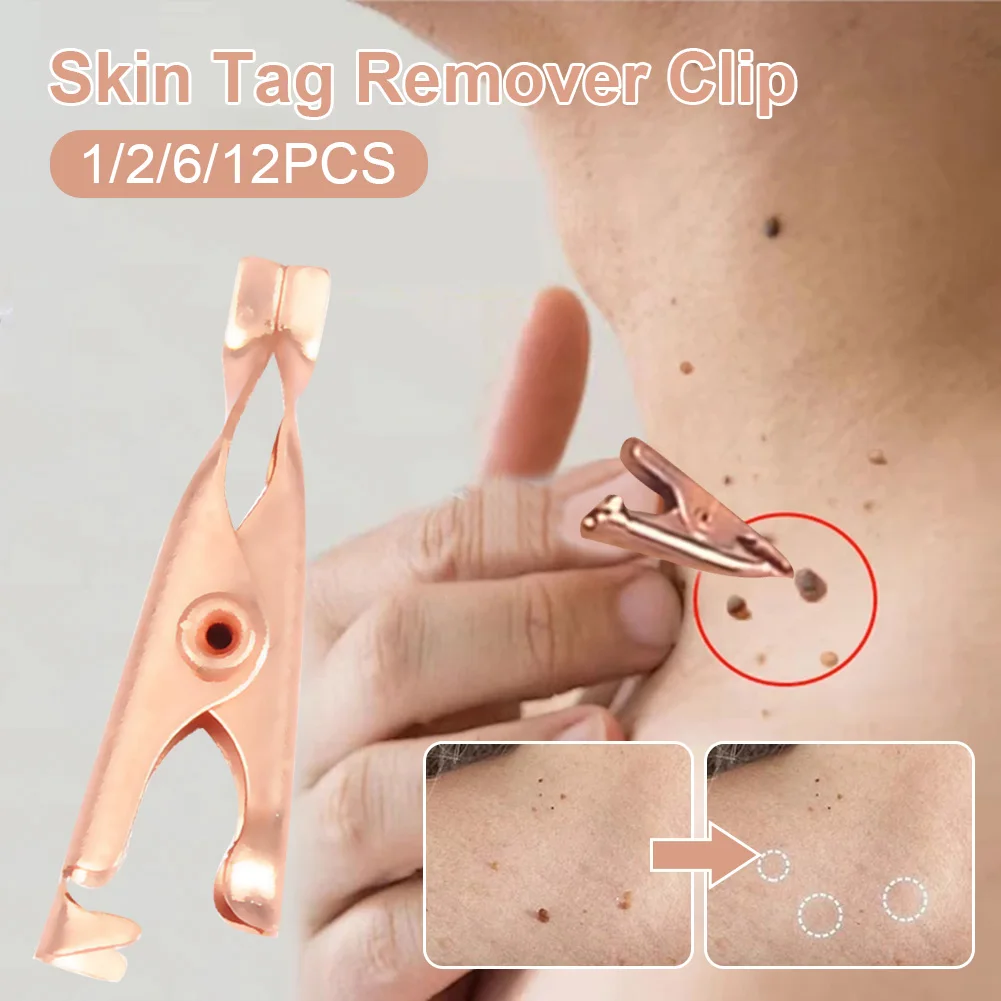 1/2/6/12Pcs Skin Tag Remover Clip Painless Mole Wart Skin Tags Removal Clips for Face Neck Body Warts Treatment Beauty Tools
1/2/6/12Pcs Skin Tag Remover Clip Painless Mole Wart Skin Tags Removal Clips for Face Neck Body Warts Treatment Beauty Tools