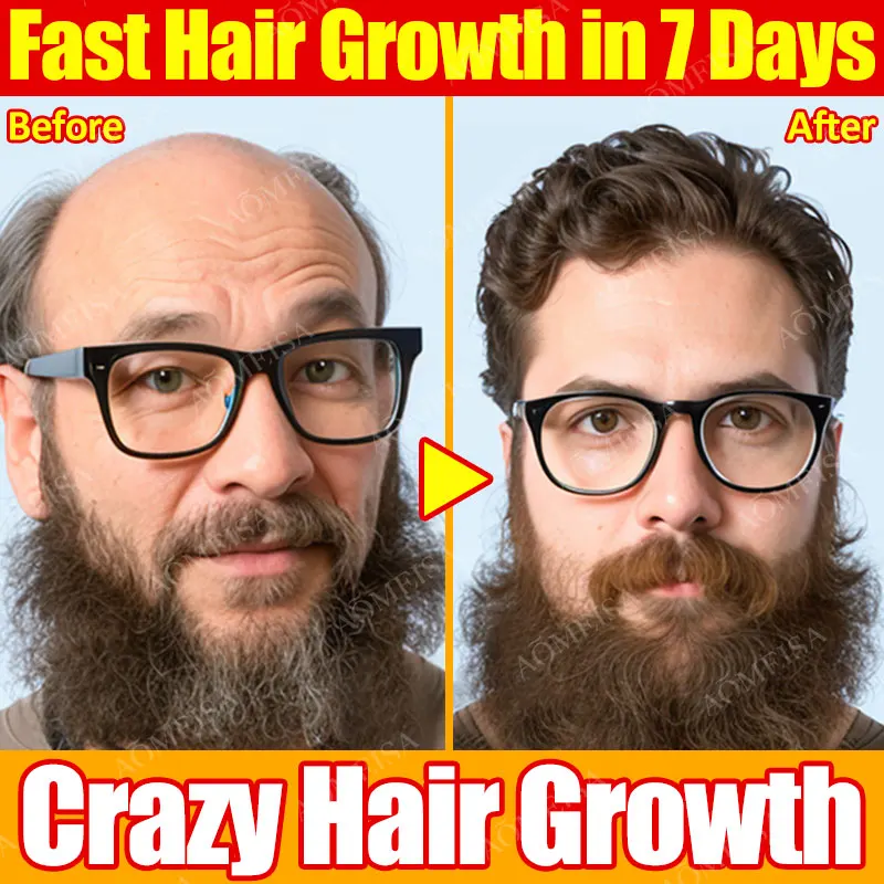 Powerful hair growth Anti-hair loss Anti-baldness Fast hair growth Hair loss treatment Hair regrowth Fast Hair Growth Oil
Powerful hair growth Anti-hair loss Anti-baldness Fast hair growth Hair loss treatment Hair regrowth Fast Hair Growth Oil