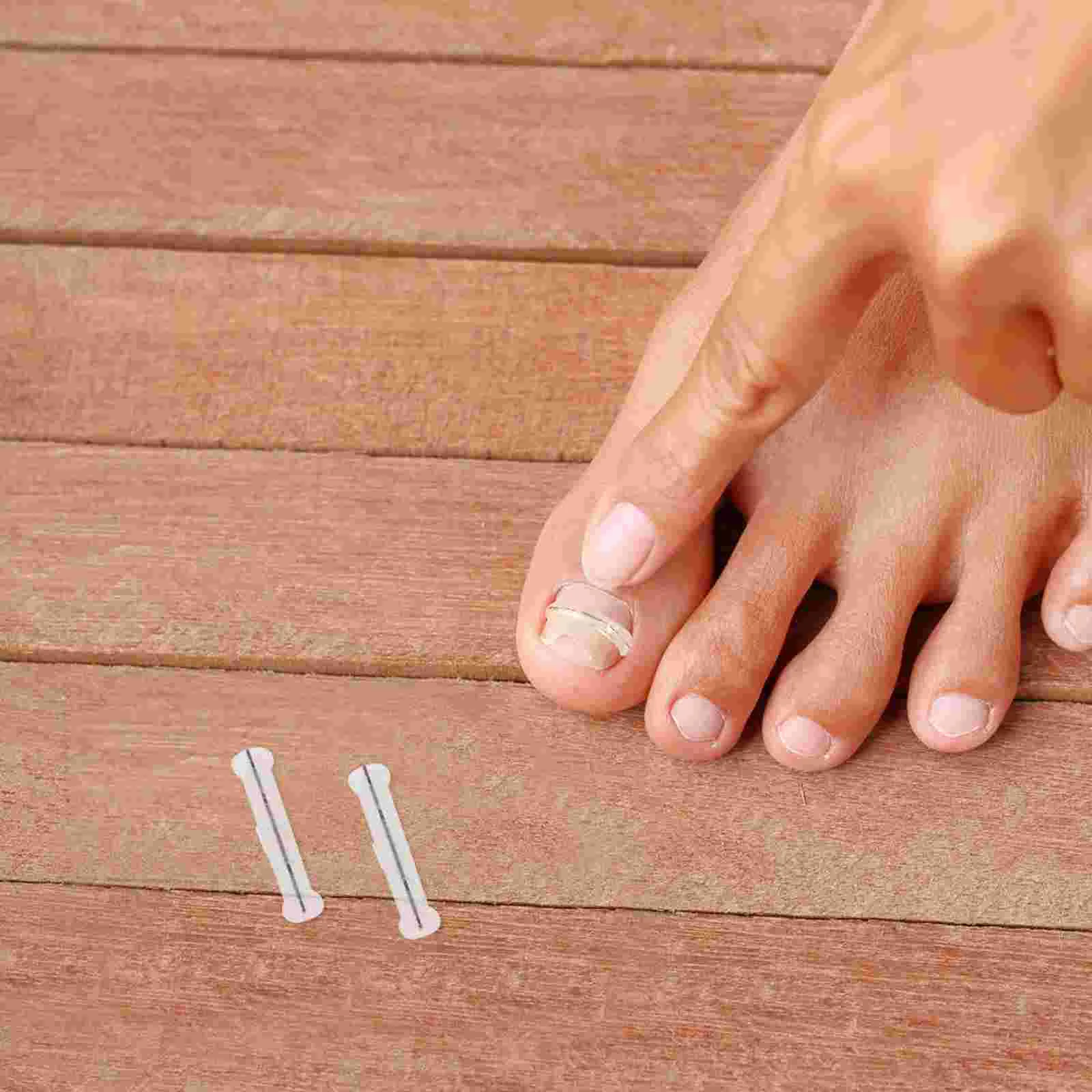 Nail Stickers Convenient Toenail Corrector Wear-resistant Small Correction Wire Home Tools
Nail Stickers Convenient Toenail Corrector Wear-resistant Small Correction Wire Home Tools