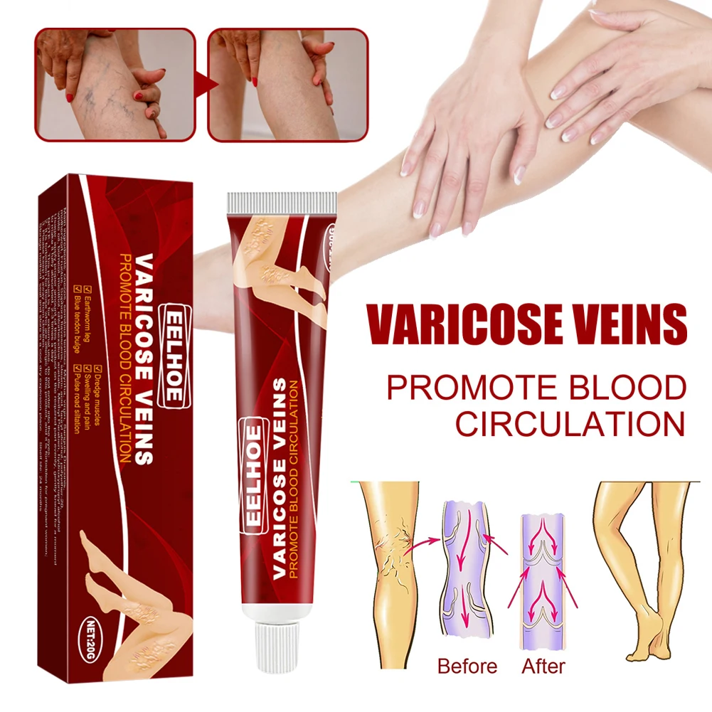 Varicose Veins Treatment Cream Vasculitis Phlebitis Spider Pain Relief Ointment Angiitis Plaster Body Health Care
Varicose Veins Treatment Cream Vasculitis Phlebitis Spider Pain Relief Ointment Angiitis Plaster Body Health Care