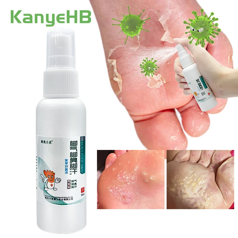 1Pcs Herbal Athlete's Foot Spray Anti Itch Sweat Odor Anti-fungi Spray Peeling Calluses Cutin Foot Tinea Medicated Spray S062
1Pcs Herbal Athlete's Foot Spray Anti Itch Sweat Odor Anti-fungi Spray Peeling Calluses Cutin Foot Tinea Medicated Spray S062