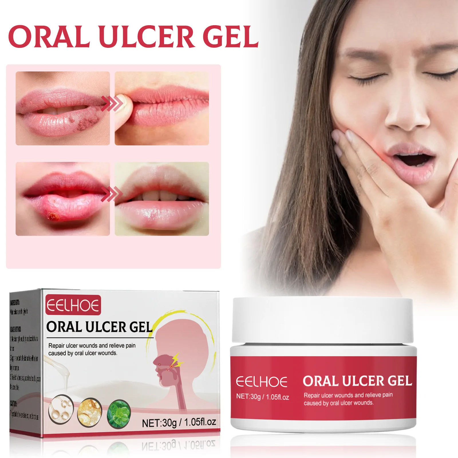 Oral Ulcer Gel Eliminate Mouth Tongue Blistering Gum Fire Gum Wound Removes Swelling Pain Soothes Repair Gel Reduce Oral Problem
Oral Ulcer Gel Eliminate Mouth Tongue Blistering Gum Fire Gum Wound Removes Swelling Pain Soothes Repair Gel Reduce Oral Problem