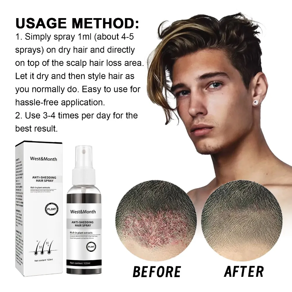 Hair Loss Care Beard Growth Oil Scalp Treatment Essence Anti-Shedding Hair Spray Growth Serum Hair Growth Spray
Hair Loss Care Beard Growth Oil Scalp Treatment Essence Anti-Shedding Hair Spray Growth Serum Hair Growth Spray