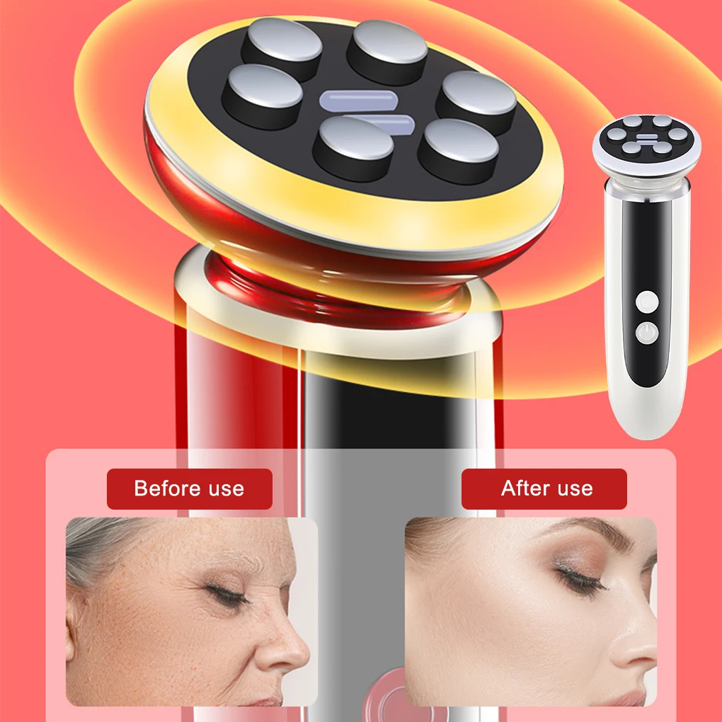 RF Radio Mesotherapy Electroporation lifting Beauty LED Face Skin Rejuvenation Remover Wrinkle Radio Frequency Skin Care Device
RF Radio Mesotherapy Electroporation lifting Beauty LED Face Skin Rejuvenation Remover Wrinkle Radio Frequency Skin Care Device