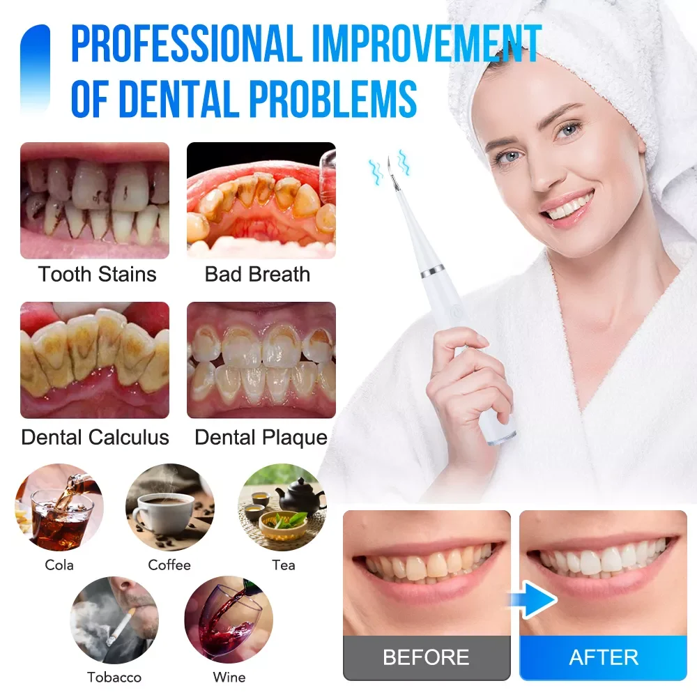 Toothbrush Sonic Dental Scaler Teeth Whitening kit Tooth Whitener Calculus Tartar Remover Tools Cleaner Stain Care
Toothbrush Sonic Dental Scaler Teeth Whitening kit Tooth Whitener Calculus Tartar Remover Tools Cleaner Stain Care