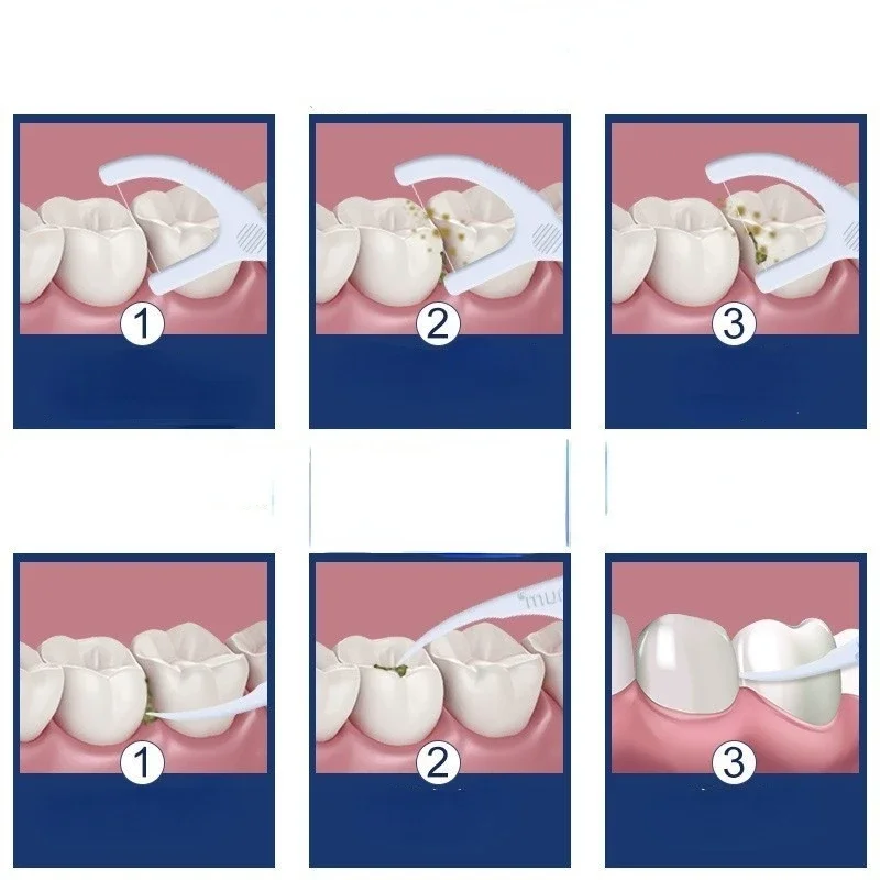 30 шт., L-образная зубная нить 
30 шт., L-образная зубная нить