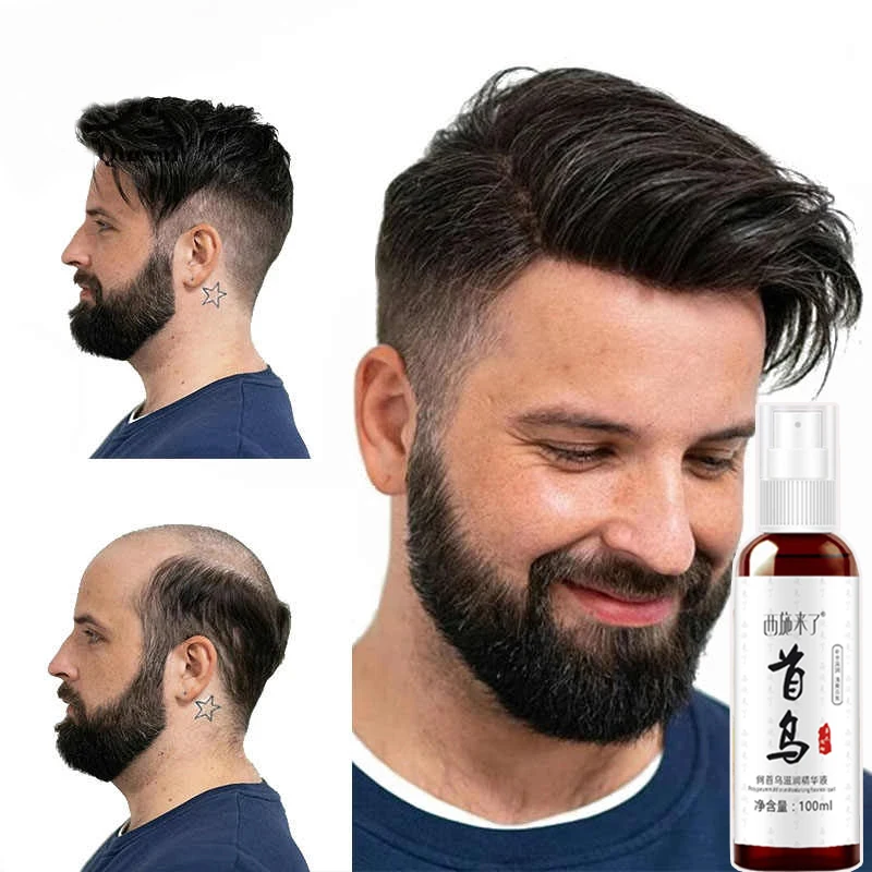 Антипотеря волос спрей для быстрого роста волос питательная сыворотка лечение алопеции Предотвращение сухой завивки улучшение повреждения волосяного фолликула тоник
Антипотеря волос спрей для быстрого роста волос питательная сыворотка лечение алопеции Предотвращение сухой завивки улучшение повреждения волосяного фолликула тоник