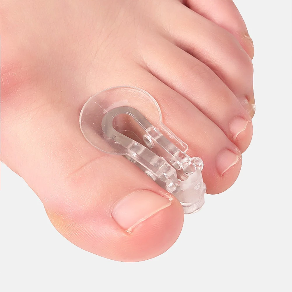 2pcs Toe Separators Spreader Spacers for Hallux Valgus Correction Silicone Pad Thumb Orthotics Toes Relieve Pains Foot Care Tool
2pcs Toe Separators Spreader Spacers for Hallux Valgus Correction Silicone Pad Thumb Orthotics Toes Relieve Pains Foot Care Tool