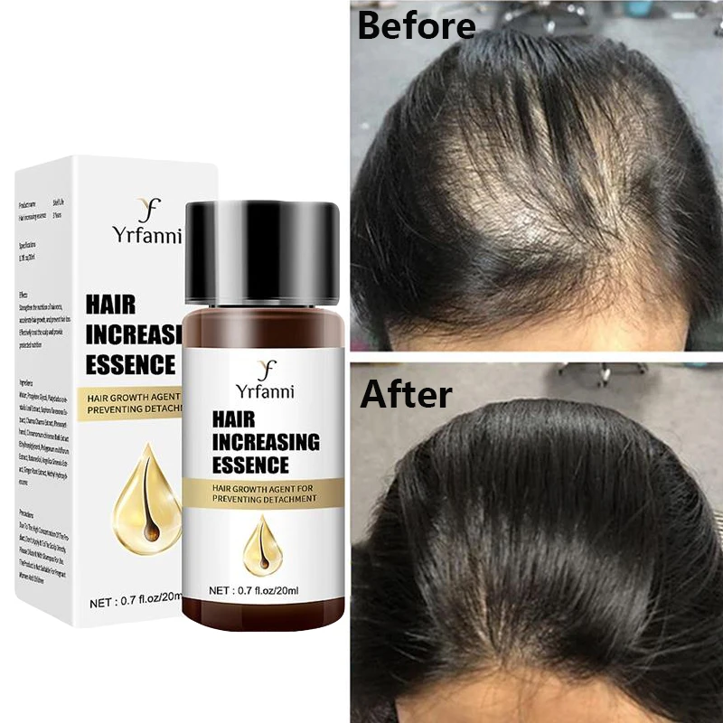Powerful Ginger Hair Growth Serum Anti Hair Loss Treatment Promote Fast Growing Repair Men Women Hair Care Beauty Health 20ml
Powerful Ginger Hair Growth Serum Anti Hair Loss Treatment Promote Fast Growing Repair Men Women Hair Care Beauty Health 20ml