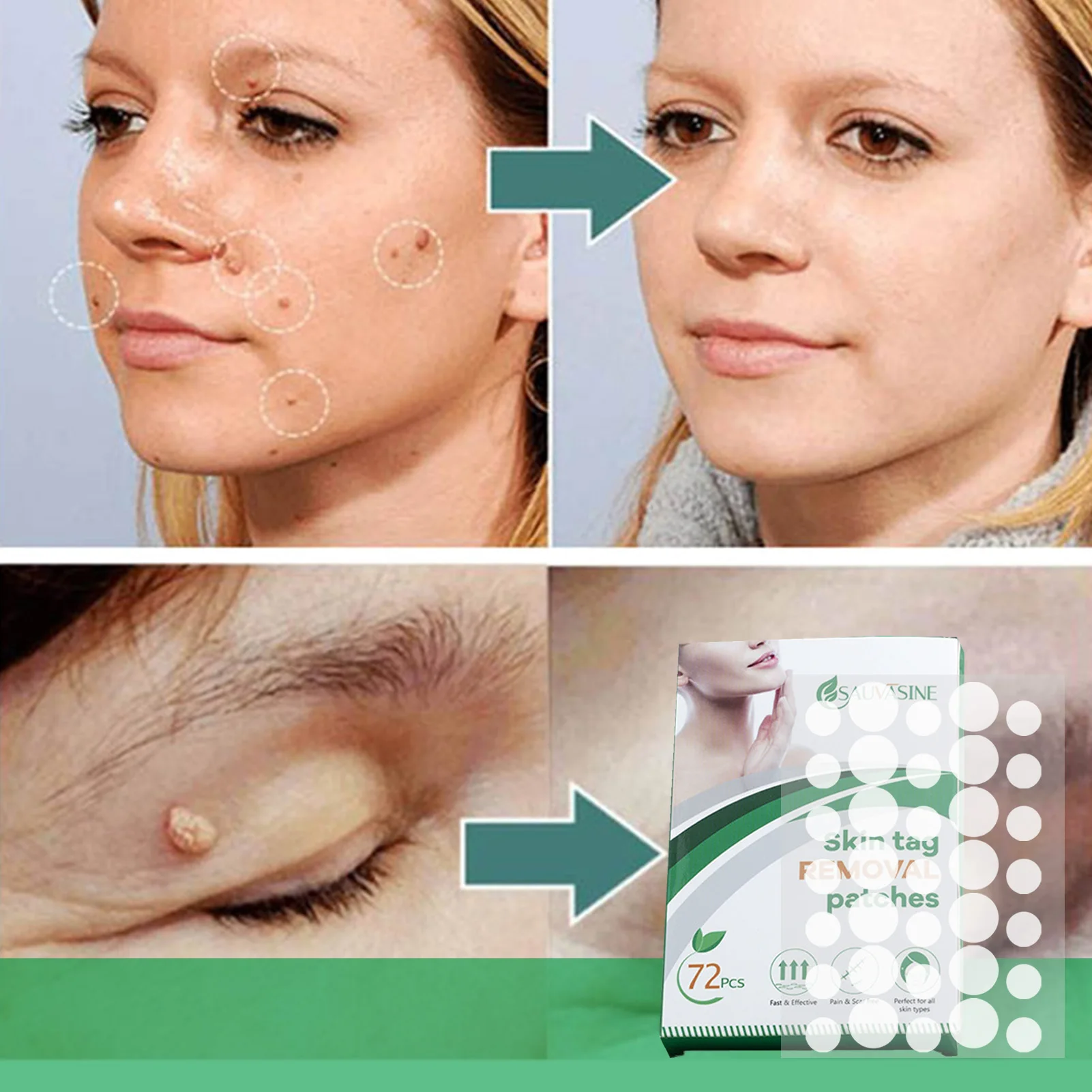 Acne Remove Patches Skin Tag Body Wart Treat Sticker Hydrocolloid Gel Invisible Acne Patch Pimple Remover Beauty Skin Care
Acne Remove Patches Skin Tag Body Wart Treat Sticker Hydrocolloid Gel Invisible Acne Patch Pimple Remover Beauty Skin Care
