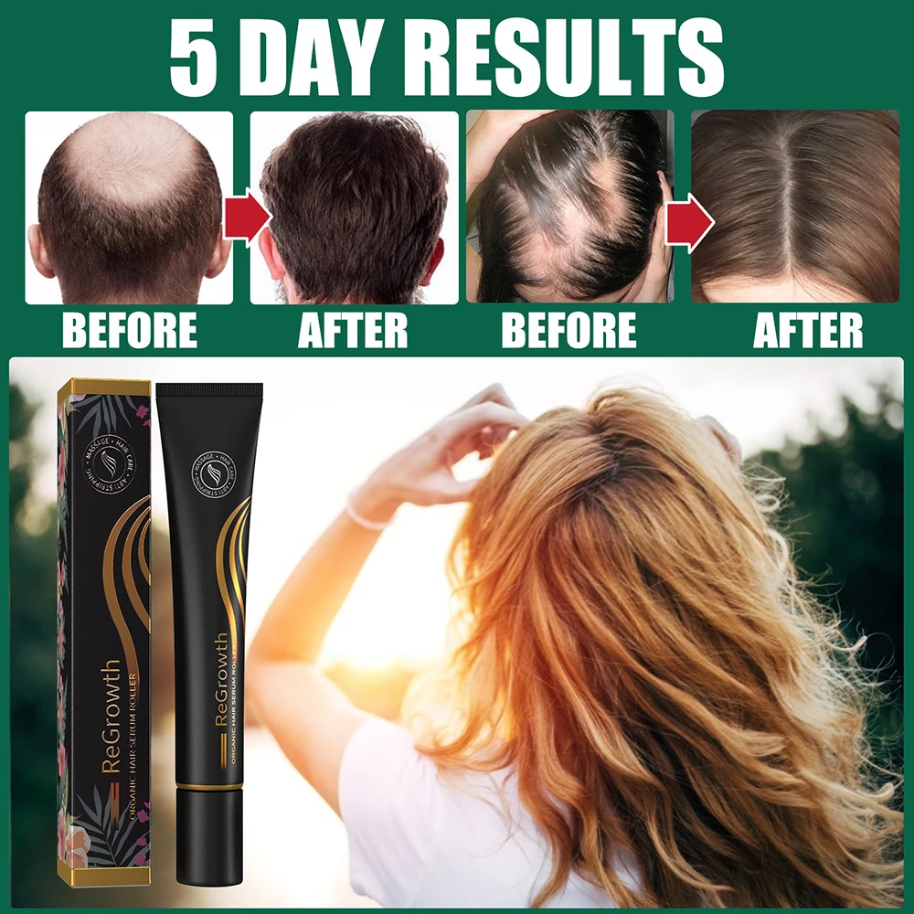 

New Regrowth Organic Hair Serum Roller Set Rolling Ball Massage Hair Growth Care Essence Anti-Dropping Liquid Improve Hair Lose