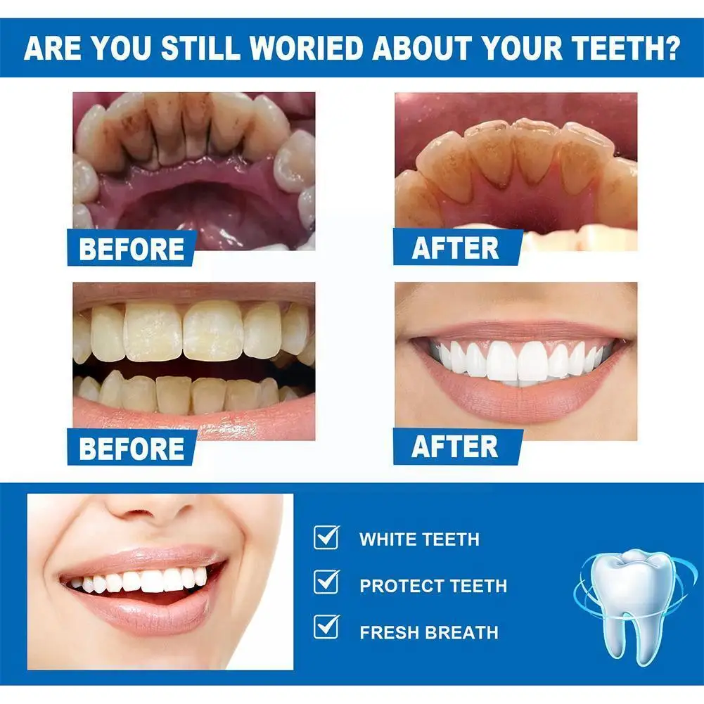 Отбеливающая Сыворотка для зубов, 10 мл
Отбеливающая Сыворотка для зубов, 10 мл