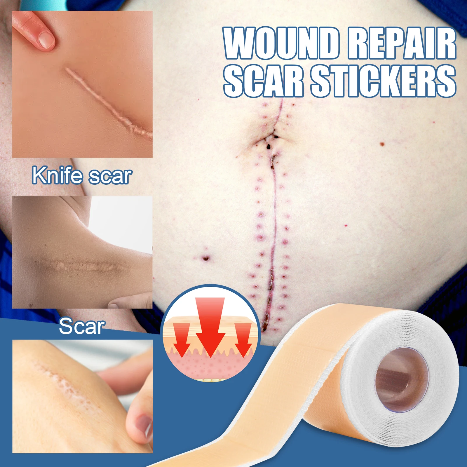 Efficient Surgery Self-Adhesive Silicone Gel Tape Removal Scar Tape Therapy Patch for Acne Trauma Burn Scar Skin Repair 4*150cm
Efficient Surgery Self-Adhesive Silicone Gel Tape Removal Scar Tape Therapy Patch for Acne Trauma Burn Scar Skin Repair 4*150cm