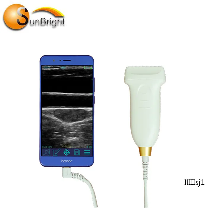 

High frequency ultrasound probe 14mhz wireless USB Linear probe price