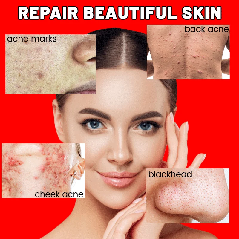 Facial Whitening Essence Hydrating Moisturizing Shrinks Pores Brightening Skin Care Firming Facial Essence Deep Korean Niacinami
Facial Whitening Essence Hydrating Moisturizing Shrinks Pores Brightening Skin Care Firming Facial Essence Deep Korean Niacinami