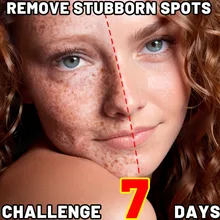 Effective Whitening Serum Remove Dark Spots Freckle Essence Anti-Aging Fade Pigmentation Melasma Brighten Beauty Face Skin Care