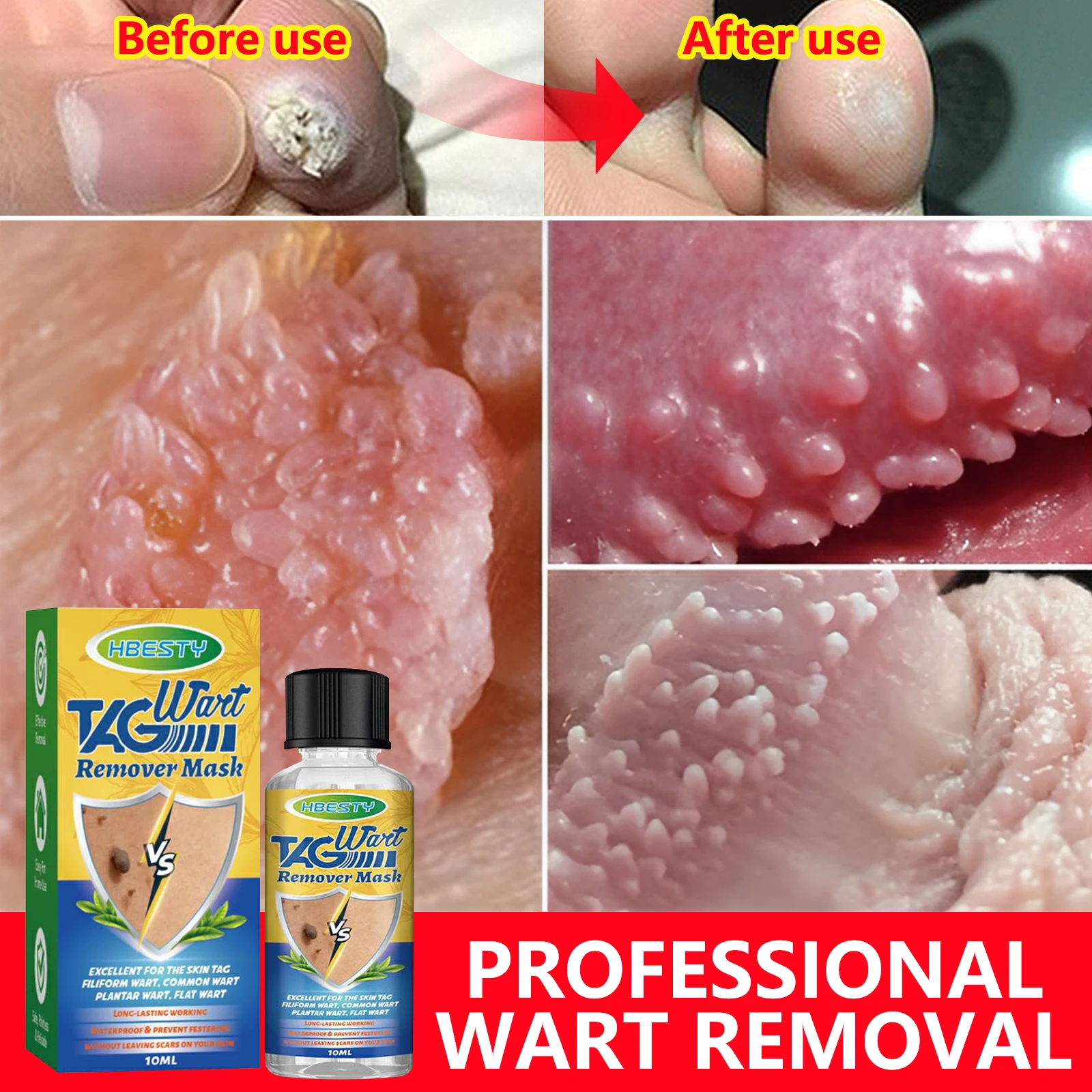 Wart Removal Essential Oil Remover Skin Tags Treatment Papillomas Body Flat Wart Painless Repair Black Spot Beauty Herb Care
Wart Removal Essential Oil Remover Skin Tags Treatment Papillomas Body Flat Wart Painless Repair Black Spot Beauty Herb Care