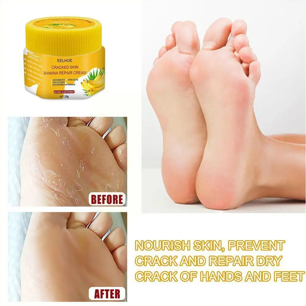 Banana Oil Anti Crack Foot Cream Anti-drying Foot Skin Feet Heel Moisturiz Dead Cream Removal Cracked Care Hand Repair A5d5
Banana Oil Anti Crack Foot Cream Anti-drying Foot Skin Feet Heel Moisturiz Dead Cream Removal Cracked Care Hand Repair A5d5