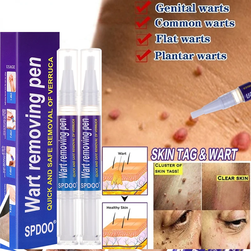 Wart Removal Mole Remedy Liquid Pen Treatment Papillomas Removing Skin Labels Flat Wart Genitals Painless Beauty Skin Care
Wart Removal Mole Remedy Liquid Pen Treatment Papillomas Removing Skin Labels Flat Wart Genitals Painless Beauty Skin Care
