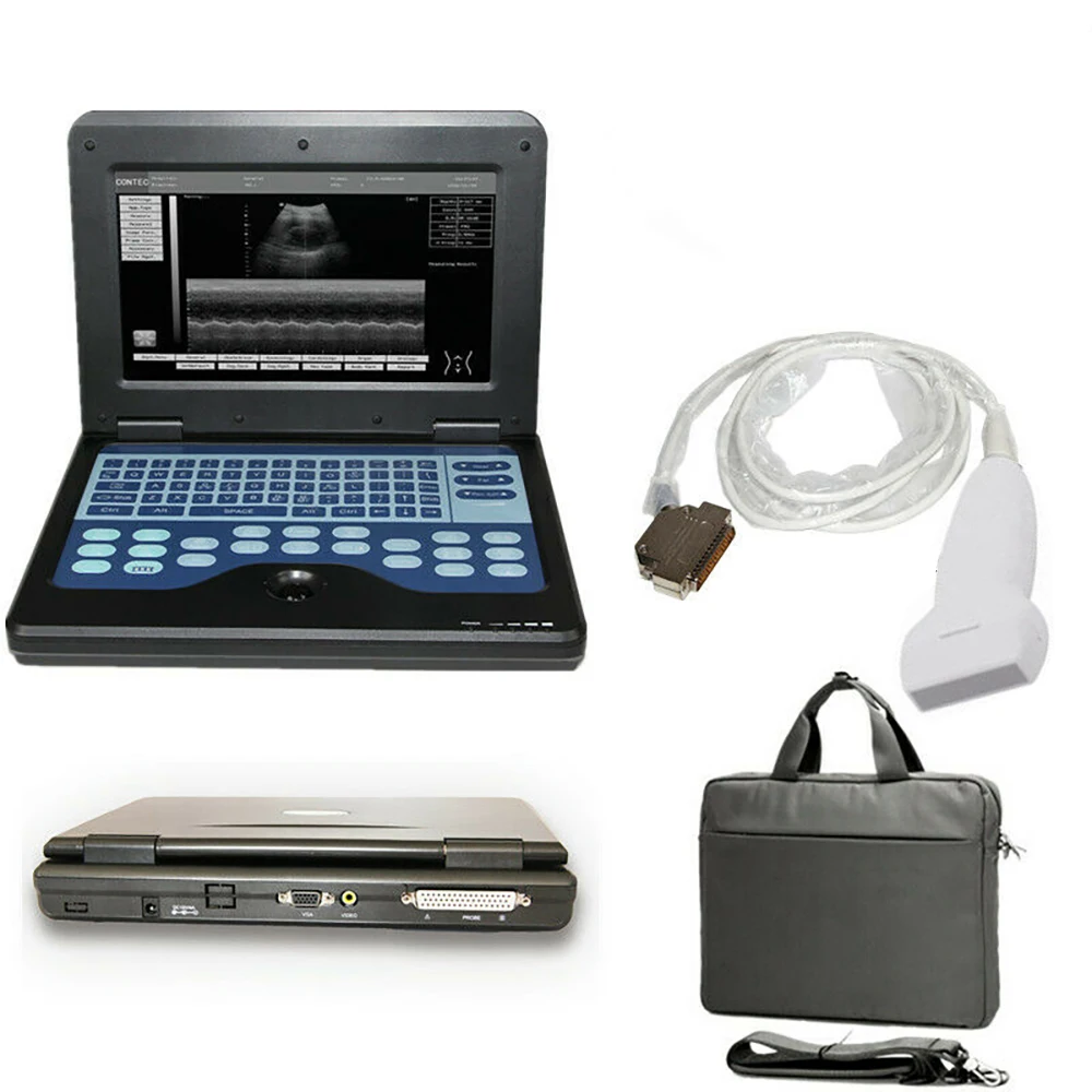 Farm Portable Veterinary Ultrasound Machine Scanner For Animals Bovine Sheep Pig Horse Dog Vet Ultrasound Scanner Equipment
Farm Portable Veterinary Ultrasound Machine Scanner For Animals Bovine Sheep Pig Horse Dog Vet Ultrasound Scanner Equipment