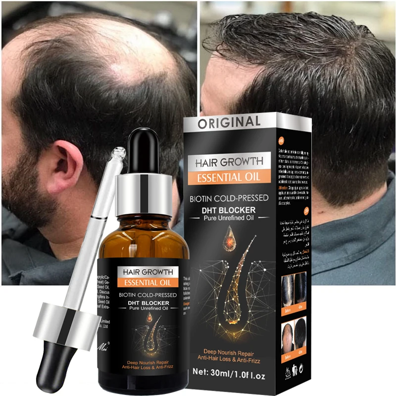 Продукт для роста волос, утолщенное средство против выпадения волос, быстрорастущее эфирное масло, стимулирует рост волосяного фолликула, ...
Продукт для роста волос, утолщенное средство против выпадения волос, быстрорастущее эфирное масло, стимулирует рост волосяного фолликула, ...