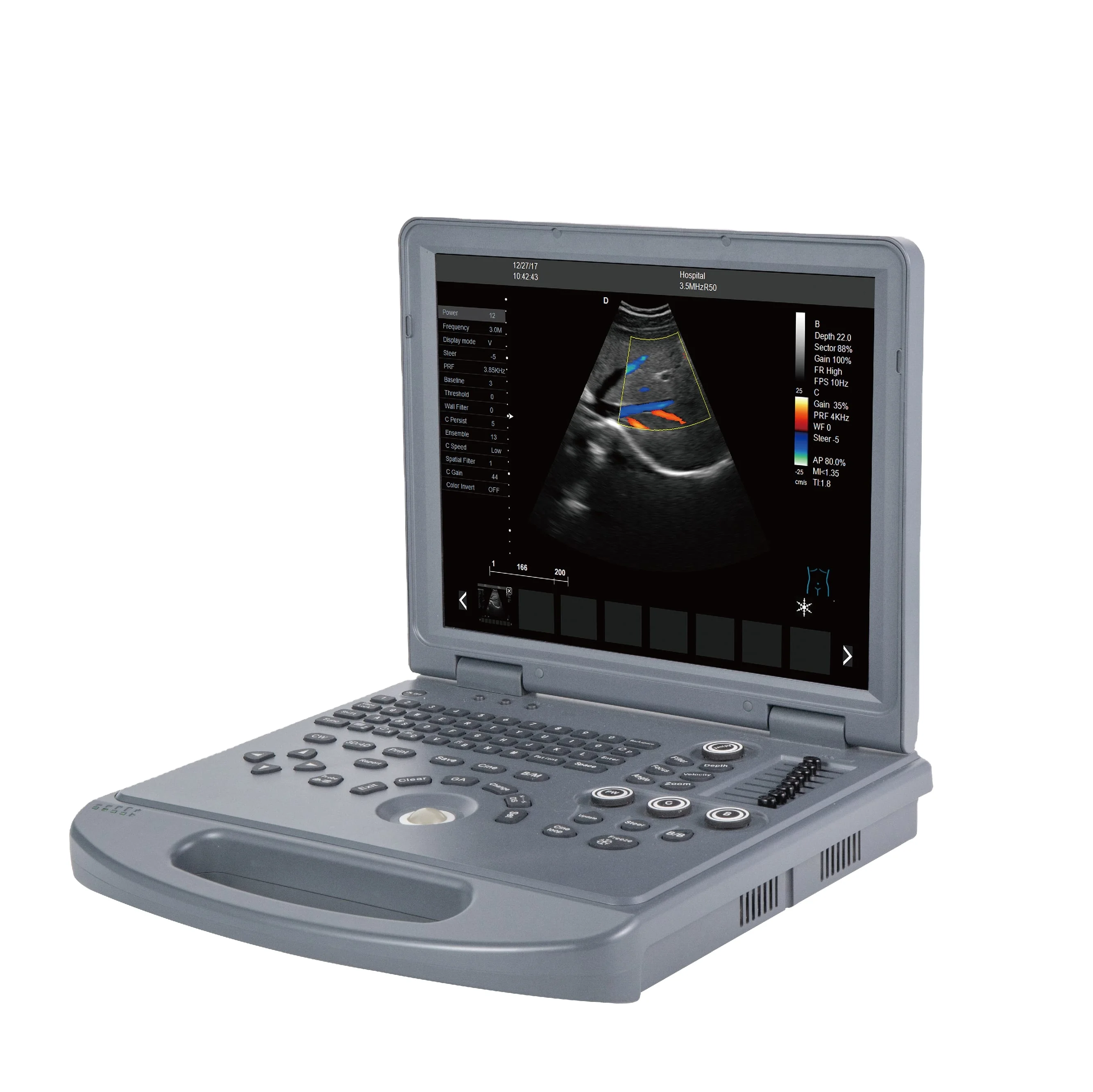 Ultrasonic, Optical, Electronic Equipment DW-VET8 basic laptop veterinary color doppler ultrasound Other Ultrasonic & El
Ultrasonic, Optical, Electronic Equipment DW-VET8 basic laptop veterinary color doppler ultrasound Other Ultrasonic & El