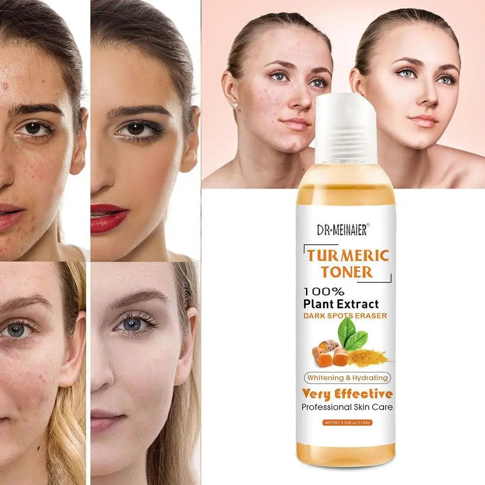 

118ml Turmeric Face Serum Whitening Dark Spot Remover Acne Scar Bright Skin Corrector Facial Essence Improve Roughness Skin Care