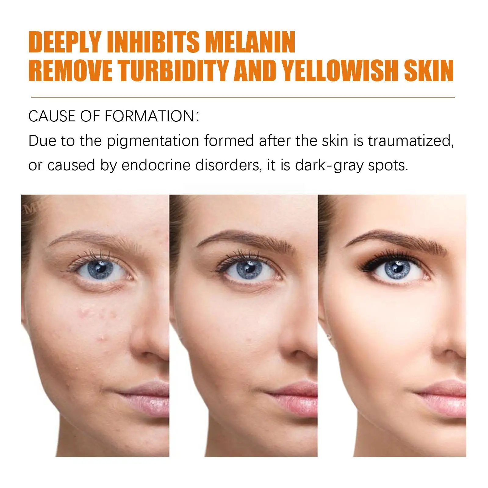 Vitamin C Whitening Cream Effectively Remove Melasma Products Freckles Skin Anti-aging Brighten Dark Face Spots Lighten Mel L8h6
Vitamin C Whitening Cream Effectively Remove Melasma Products Freckles Skin Anti-aging Brighten Dark Face Spots Lighten Mel L8h6