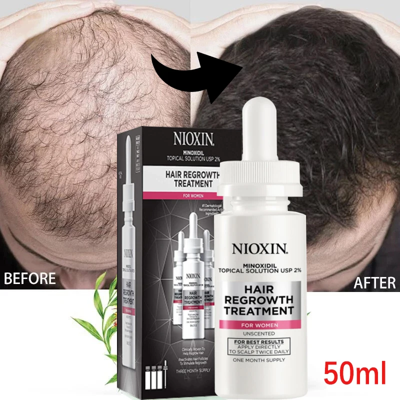 Prevent hair loss grease scalp treatment men and women instant hair care products rapid growth hair essential oil beauty care
Prevent hair loss grease scalp treatment men and women instant hair care products rapid growth hair essential oil beauty care